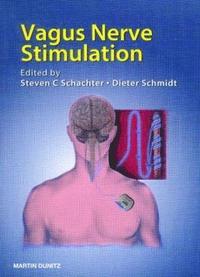 bokomslag Vagus Nerve Stimulation