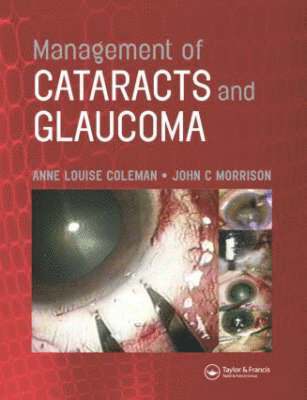 bokomslag Management of Cataracts and Glaucoma