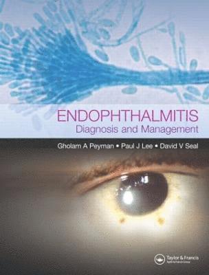 Endophthalmitis 1