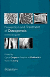 bokomslag Prevention and Treatment of Osteoporosis in the High-Risk Patient
