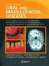 bokomslag Oral and Maxillofacial Diseases