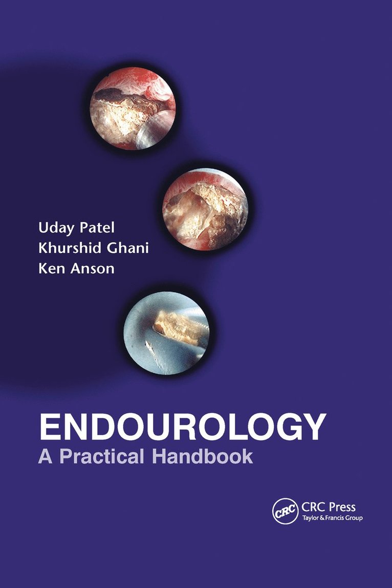 Uday Patel, Kenneth M. Anson, Khurshid Ghani, UK) Patel, Uday (St. George's Hospital Medical School, London, UK) Anson, Kenneth M. (St. George's Hospital, England, UK) Ghani, Khurshid (St Bartholomew's Hospital, London - Endourology, Häftad