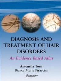 bokomslag Diagnosis and Treatment of Hair Disorders