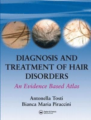 bokomslag Diagnosis and Treatment of Hair Disorders