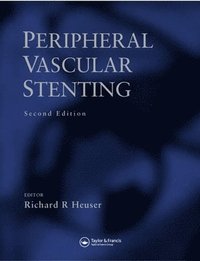 bokomslag Peripheral Vascular Stenting, Second Edition