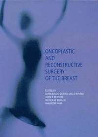 bokomslag Oncoplastic Surgery of the Breast