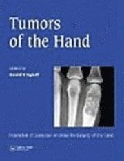 bokomslag Tumors of the Hand