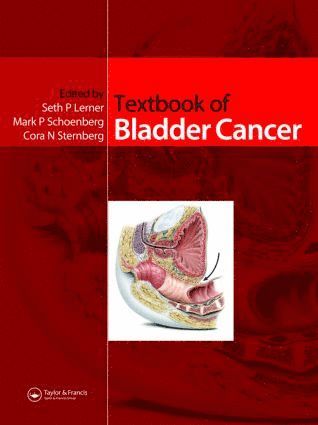 Seth P. Lerner, Mark Schoenberg, Cora Sternberg - Textbook of Bladder Cancer, Inbunden