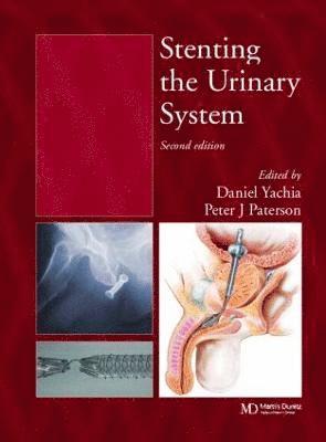 bokomslag Stenting the Urinary System