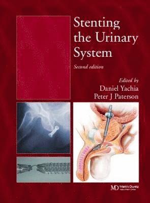 Daniel Yachia, Peter J. Paterson - Stenting the Urinary System, Inbunden