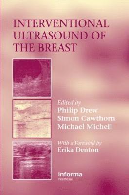 Philip Drew, Simon Cawthorn, Michael Michell, Philip (P.J.Drew@Hull.ac.uk Undeliverable Case 1686312) Drew, UK) Cawthorn, Simon (Frenchay Hospital, Bristol, UK) Michell, Michael (King's College Hospital, London - Interventional Ultrasound of the Breast, Inbunden