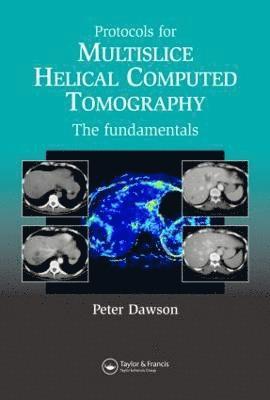 bokomslag Protocols for Multislice Helical Computed Tomography