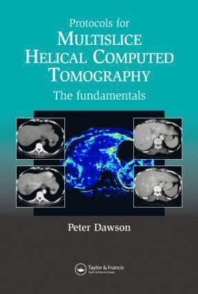 Dawson Peter - Protocols for Multislice Helical Computed Tomography, Inbunden