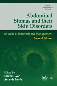 bokomslag Abdominal Stomas and Their Skin Disorders
