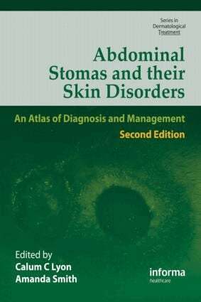 Callum C. Lyon, Amanda Smith - Abdominal Stomas and Their Skin Disorders, Inbunden
