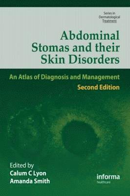 Abdominal Stomas and Their Skin Disorders 1