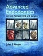 Advanced Endodontics 1