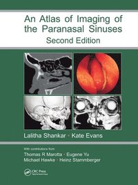 bokomslag Atlas of Imaging of the Paranasal Sinuses, Second Edition