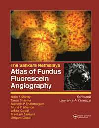 bokomslag Atlas of Fundus Fluorescein Angiography
