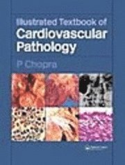 bokomslag Illustrated Textbook of Cardiovascular Pathology