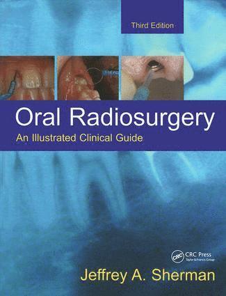 bokomslag Oral Radiosurgery