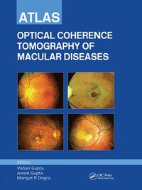 bokomslag Atlas of Optical Coherence Tomography of Macular Diseases