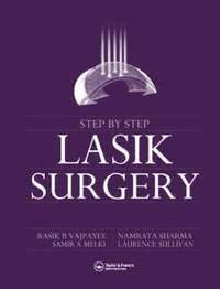 Step by Step Lasik Surgery 1