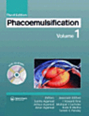 bokomslag Phacoemulsification