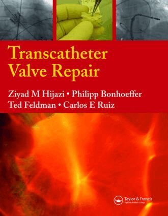 Ziyad M. Hijazi, Carlos E. Ruiz, Philipp Bonhoeffer, Ted Feldman - Transcatheter Valve Repair, Inbunden