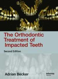 bokomslag Orthodontic Treatment of Impacted Teeth,Second Edition
