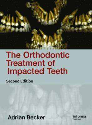 bokomslag Orthodontic Treatment of Impacted Teeth,Second Edition