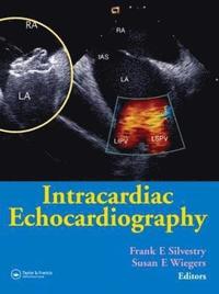 bokomslag Intracardiac Echocardiography