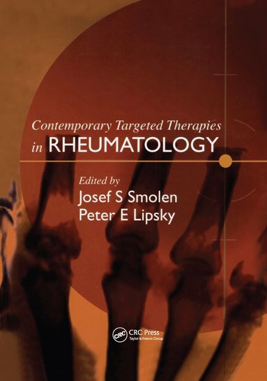 Josef S. Smolen, Peter E. Lipsky - Contemporary Targeted Therapies in Rheumatology, Inbunden