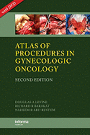 bokomslag Atlas of Procedures in Gynecologic Oncology, An