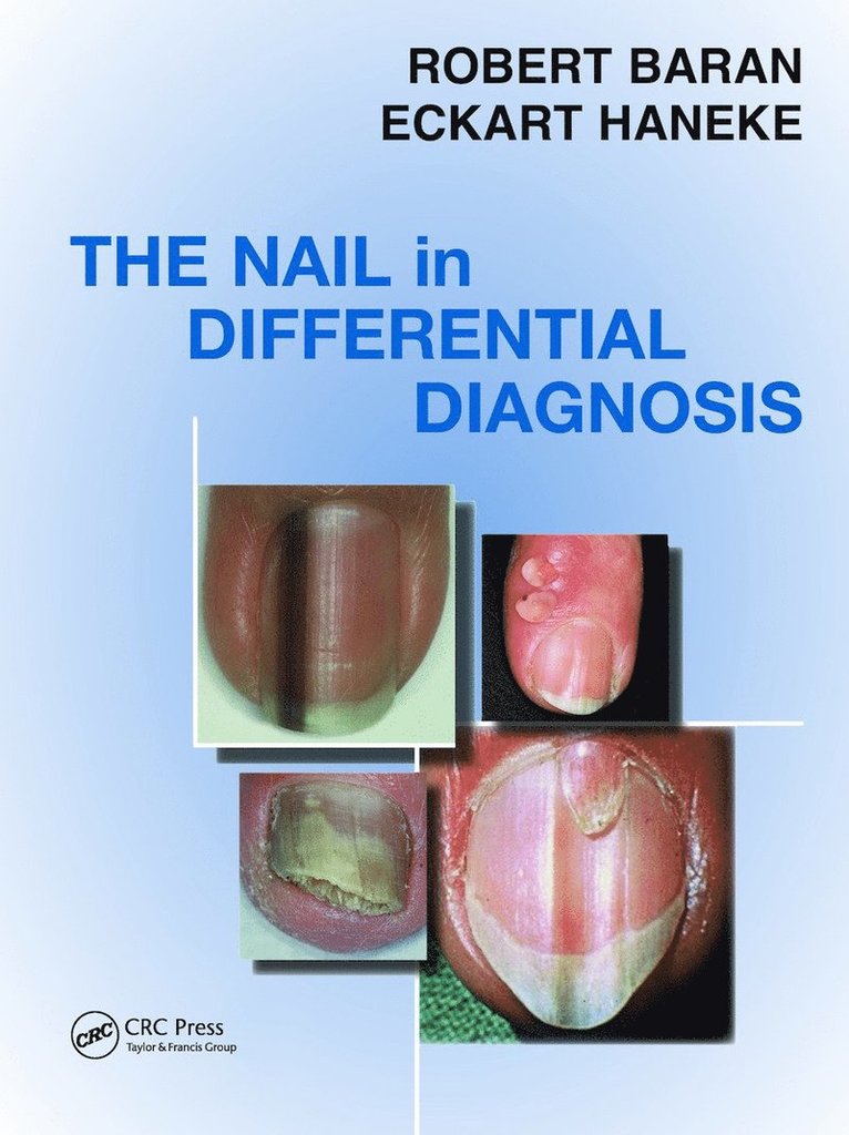 Robert Baran, Eckart Haneke - Nail in Differential Diagnosis, Inbunden
