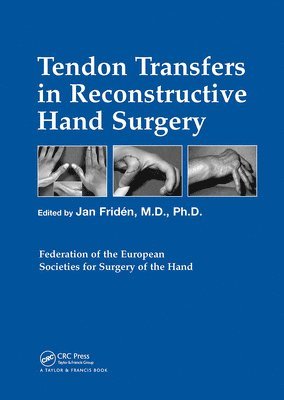 bokomslag Tendon Transfers in Reconstructive Hand Surgery