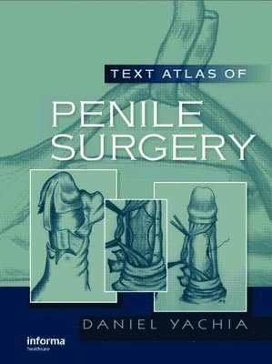 Text Atlas of Penile Surgery 1