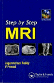 bokomslag Step by Step Pediatric MRI