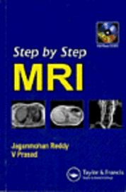 Step by Step Pediatric MRI 1