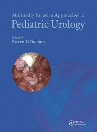 bokomslag Minimally Invasive Approaches to Pediatric Urology