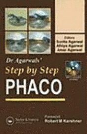 Step by Step Phacoemulsification 1