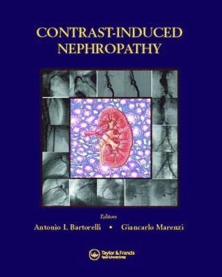 Contrast-Induced Nephropathy in Interventional Cardiovascular Medicine 1