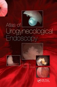 bokomslag Handbook of Urologic Cryoablation