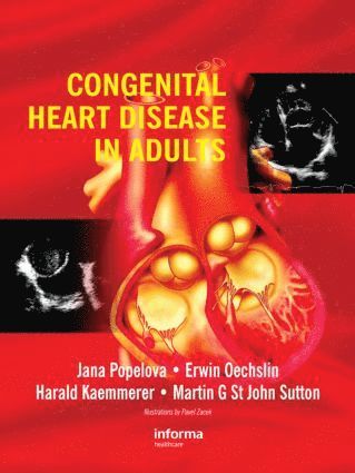 bokomslag Congenital Heart Disease in Adults