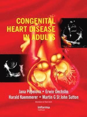Congenital Heart Disease in Adults 1