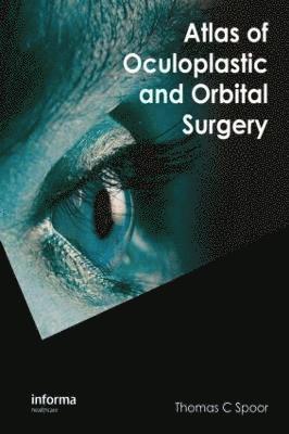 bokomslag Atlas of Oculoplastic and Orbital Surgery