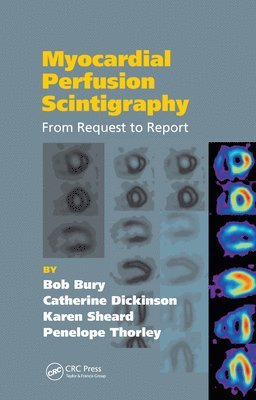 Myocardial Perfusion Scintigraphy 1