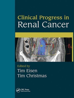 Clinical Progress in Renal Cancer 1