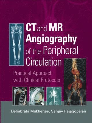 Debabrata Mukherjee, Sanjay Rajagopalan - CT and MR Angiography of the Peripheral Circulation, Inbunden