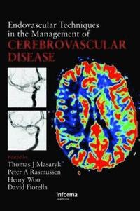 bokomslag Endovascular Techniques in the Management of Cerebrovascular Disease